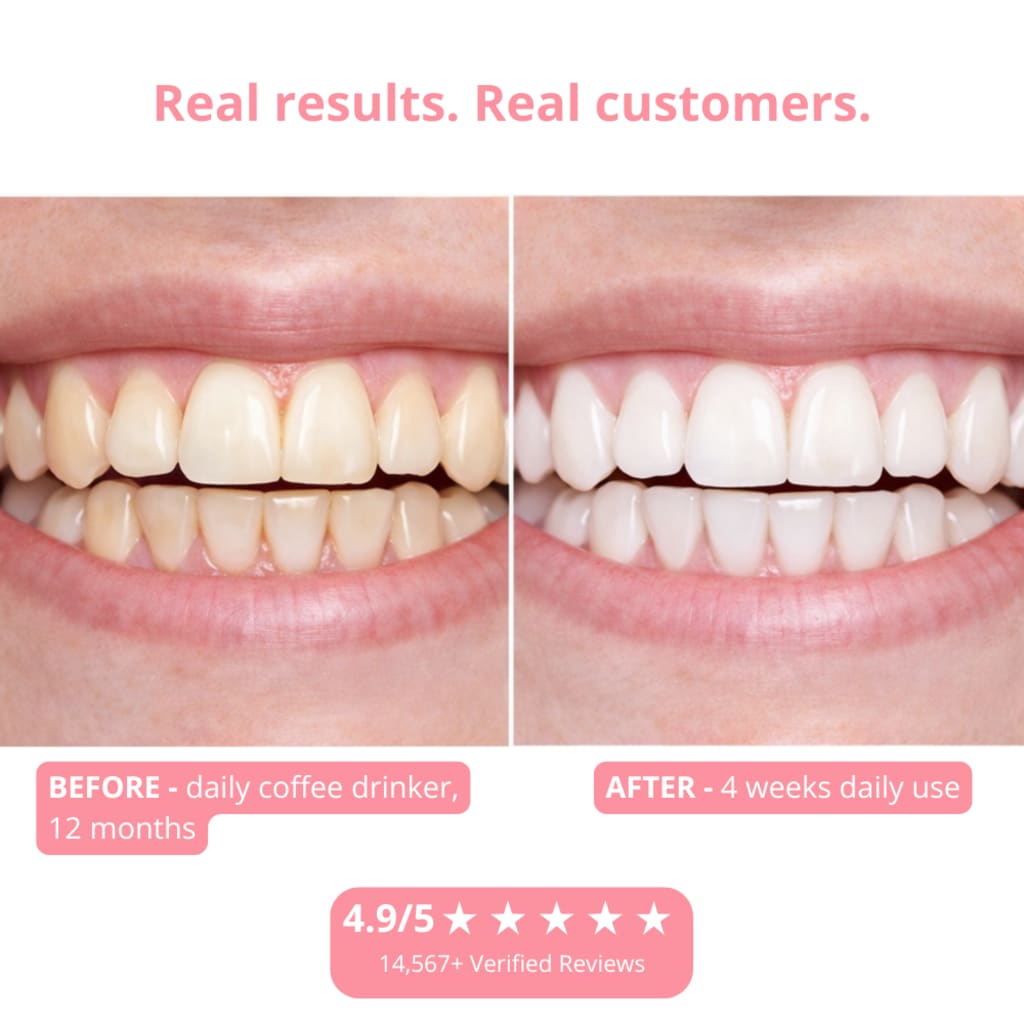Stain Reveal Mouthwash