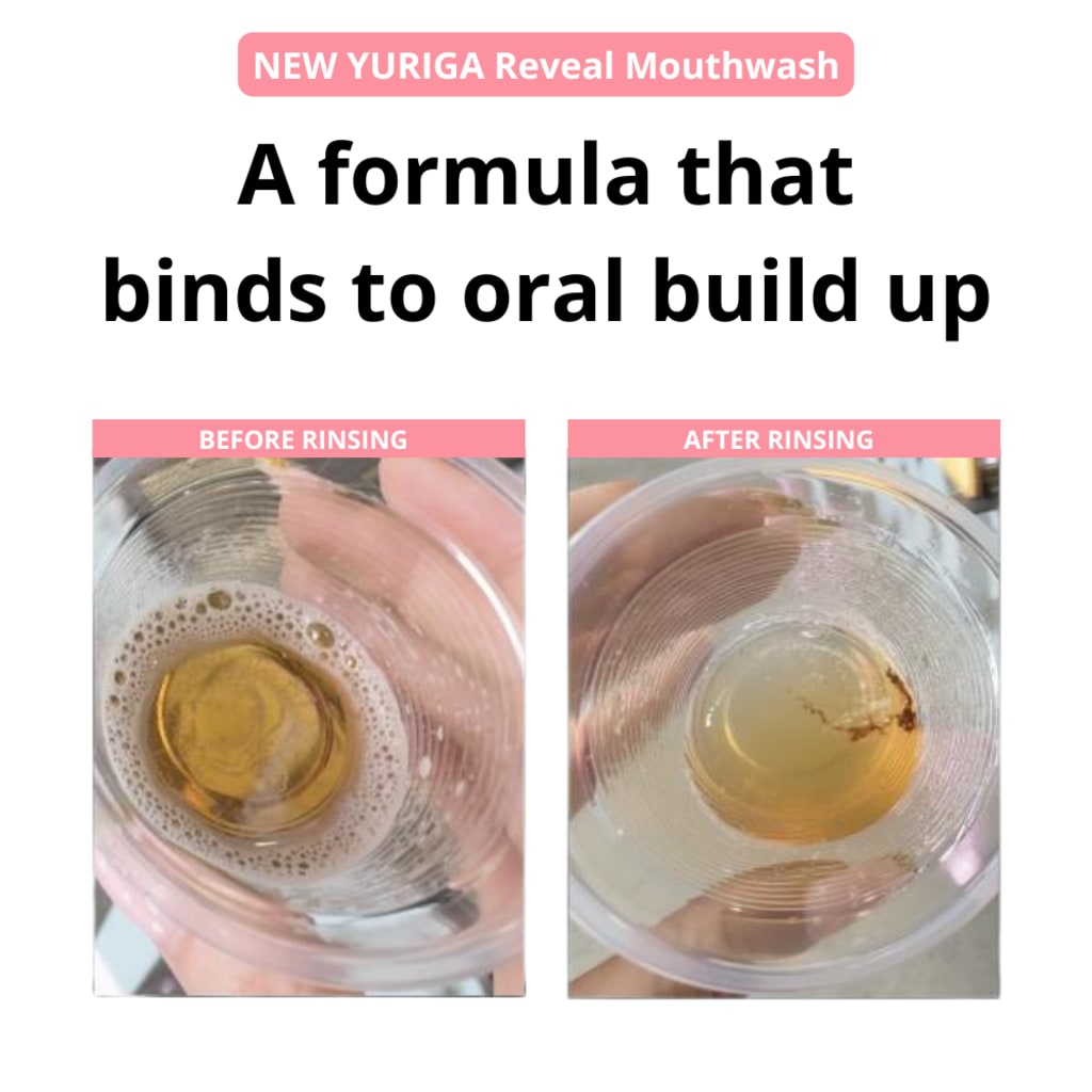 Yuriga Stain Reveal Mouthwash
